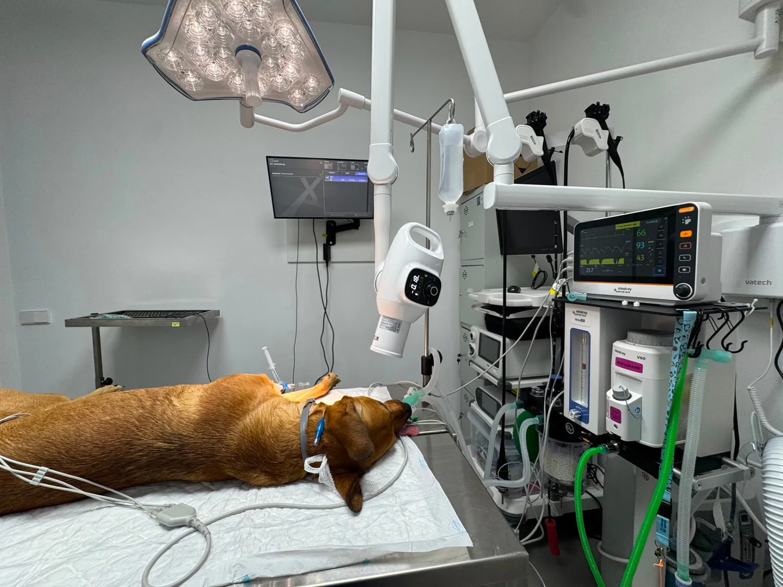 Monitored anaesthesia in the operating theatre